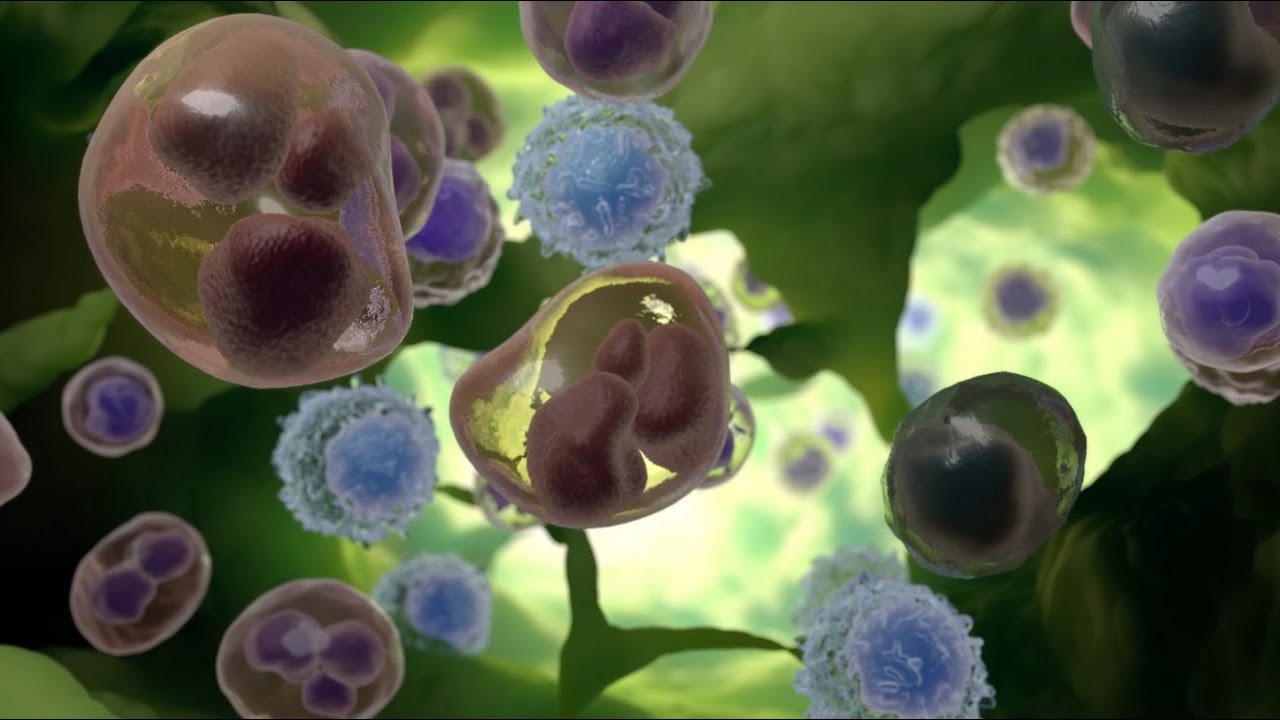 Hodgkin Lymphoma & Non-Hodgkin Lymphoma Treatment