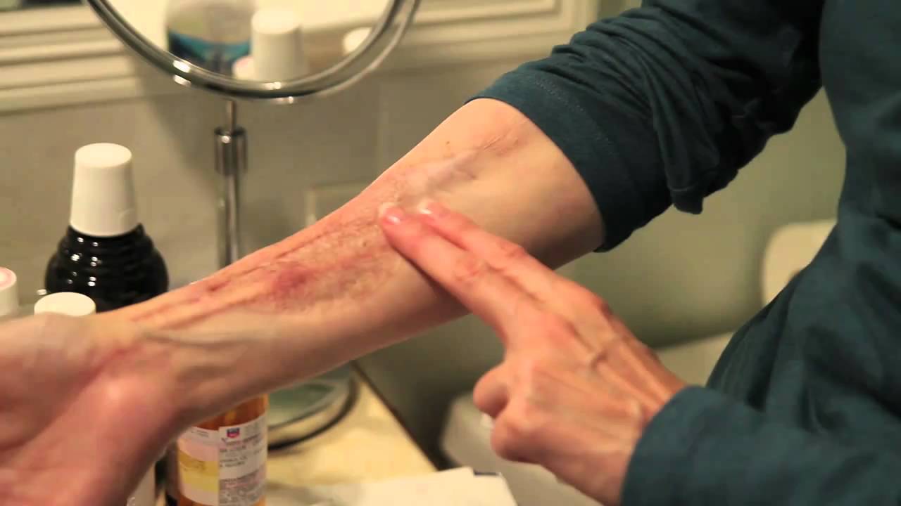 Christine - Living in Pain