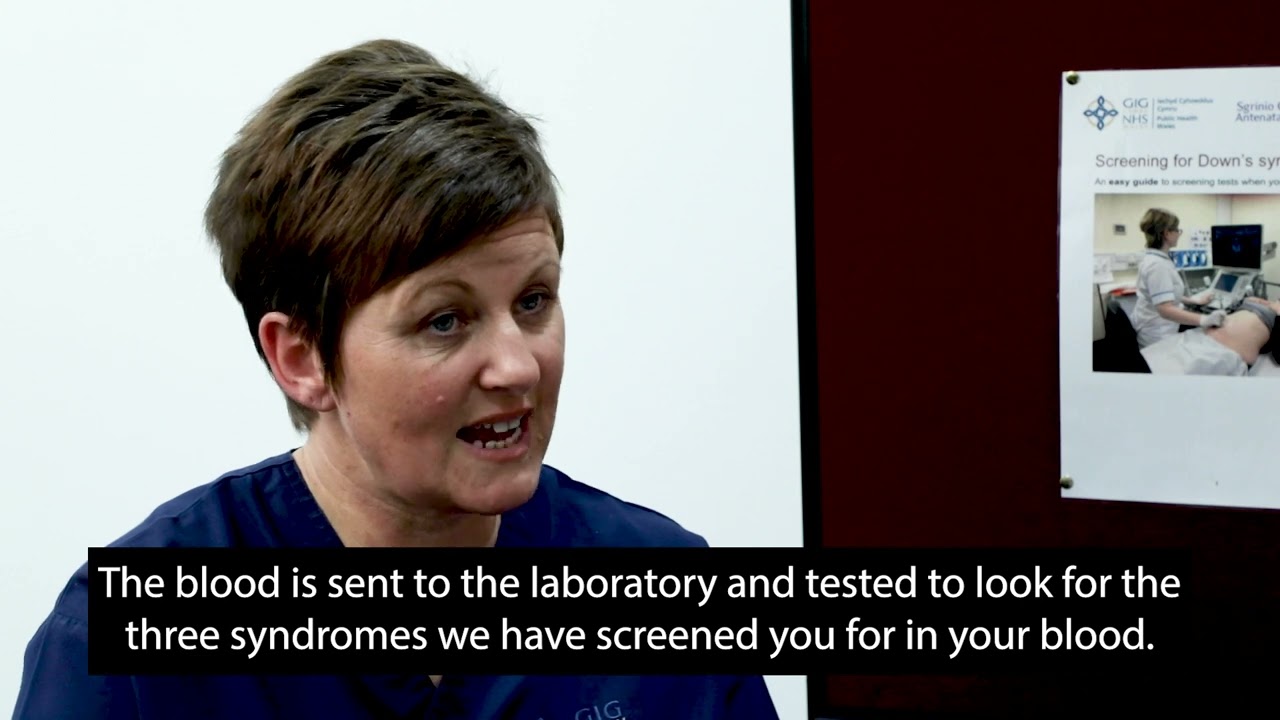 Screening for Down’s syndrome, Edwards’ syndrome and Patau’s syndrome NIPT offer in twins