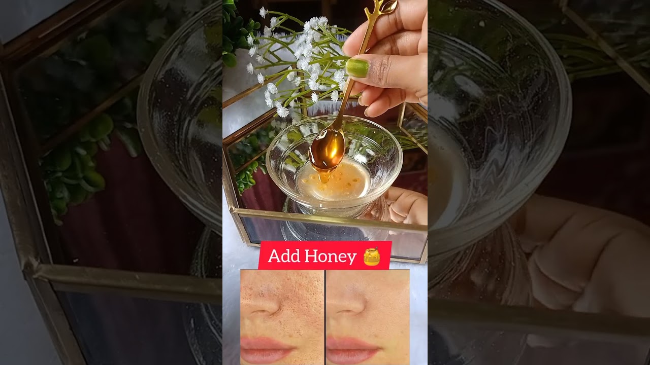🔥Open pores home remedy #openpores #skincare #skincaretips #ytshorts #viral #viralshorts #shorts