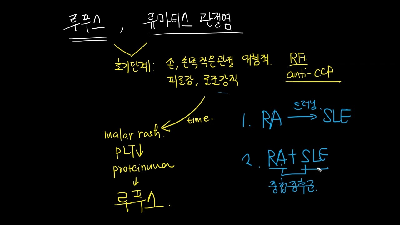lupus23 - 루푸스 vs 류마티스 관절염