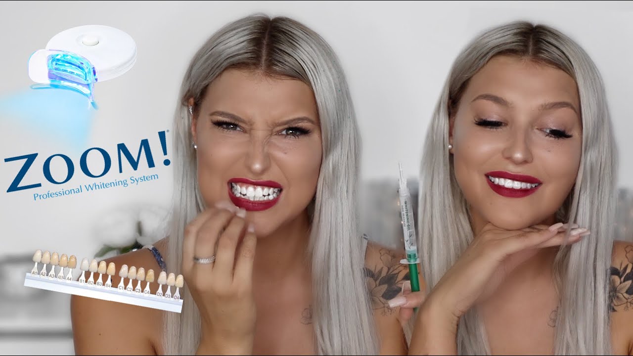 AMAZING TEETH WHITENING PRODUCTS - HOW I WHITEN & CARE FOR MY TEETH AT HOME *INEXPENSIVE*