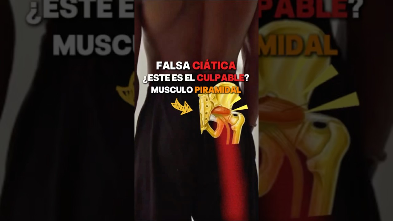 &iquest;EL CAUSANTE DE T&Uacute; DOLOR? Musculo piramidal #ciatica #curiosidades #anatomia #fisio #ejercicio