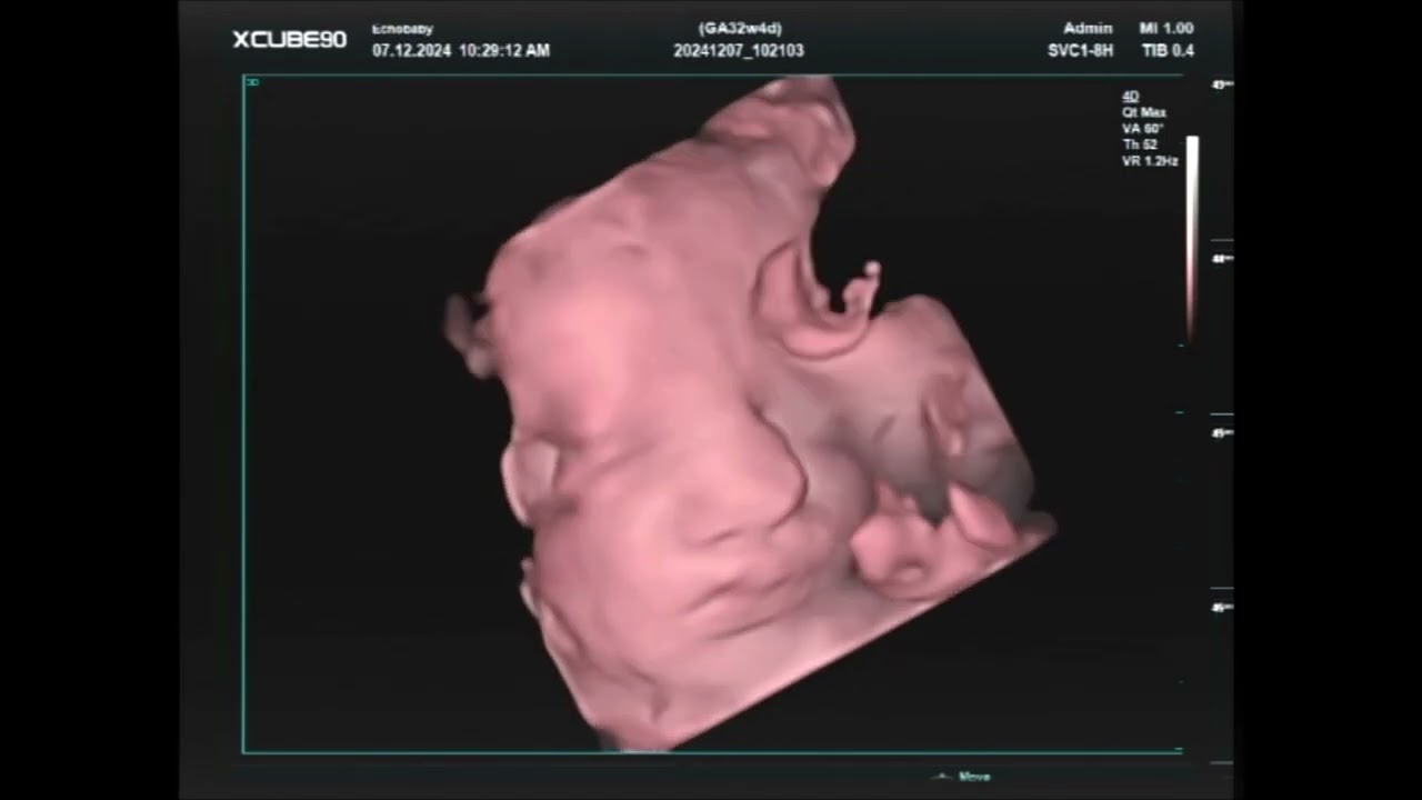 32 Weken Echo, 3D Live Filmpje