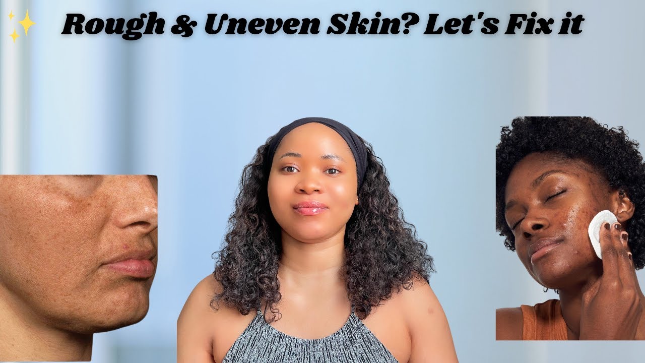 Uneven Texture & Dull Skin | Why Your Glow Disappears & How to Get It Back