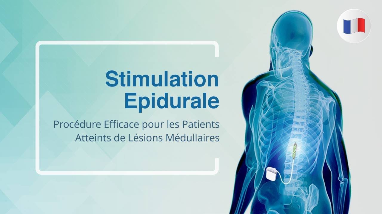 Stimulation Epidurale: Procédure Efficace pour les Patients Atteints de Lésions Médullaires