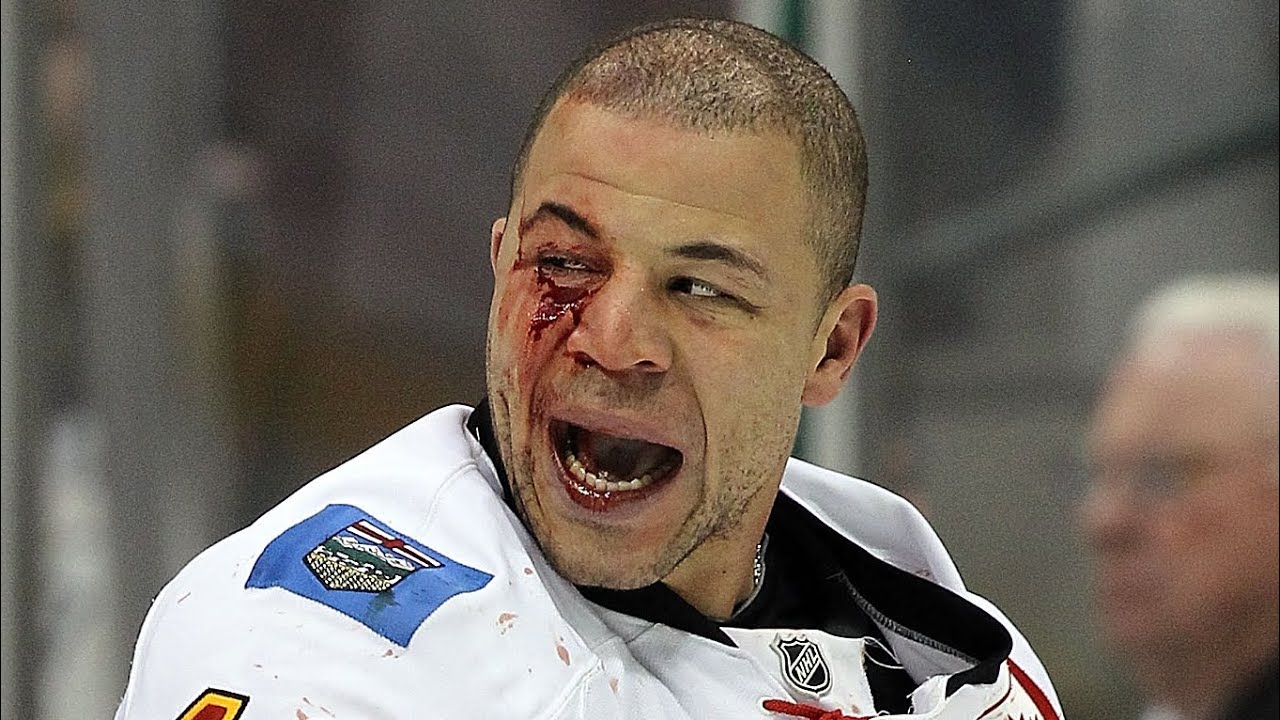 Jarome Iginla Fights