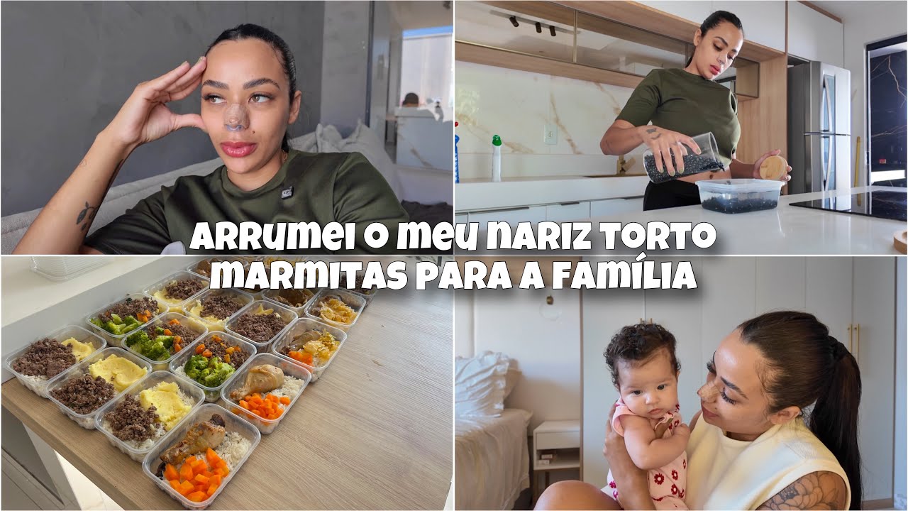 INVENTEI DE MEXER NO NARIZ DE NOVO | RINOMODELAÇÃO SECUNDÁRIA | PREPAREI MARMITAS DA SEMANA