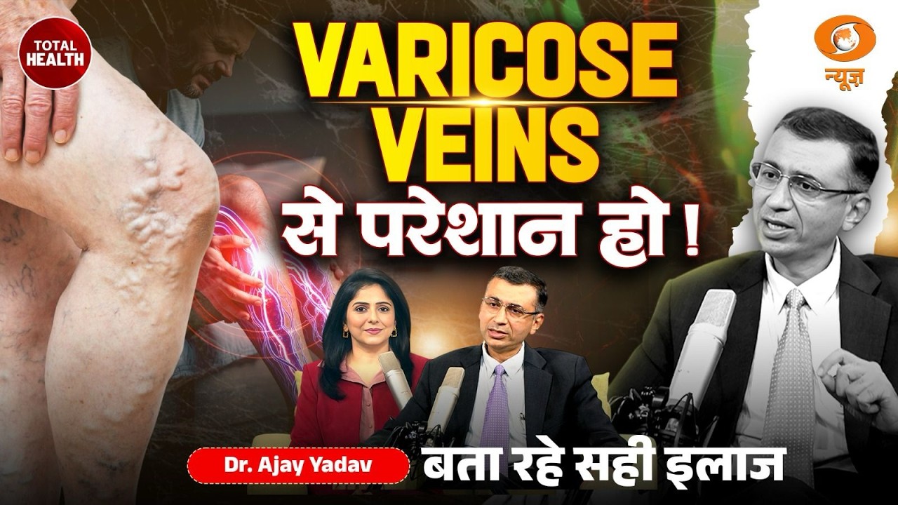 Varicose Veins की अनदेखी पड़ सकती है भारी | लक्षण और पक्का इलाज| vascular surgeon | Total Health