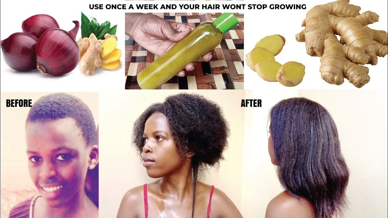 How I Use Onion and Ginger for Unstopable Hair Growth | 4C Hair  | Natural Hair