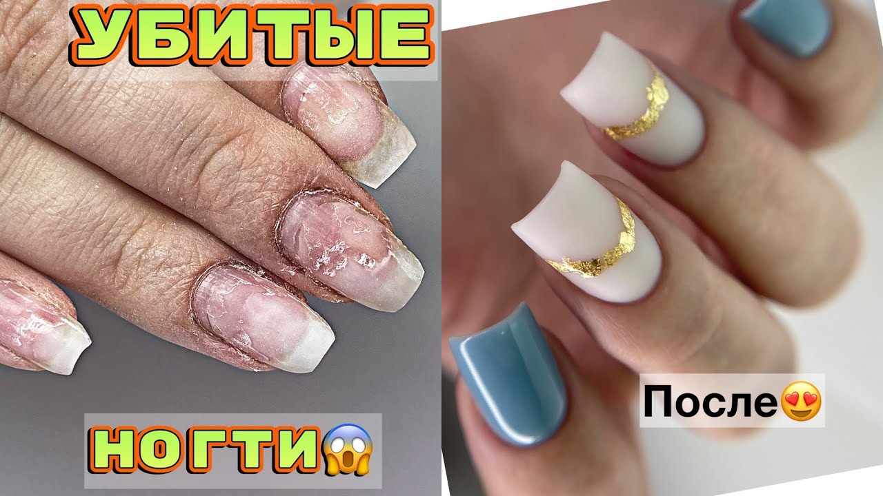 УБИТЫЕ ногти 🙁 Сложный случай 💅 Маникюр в МАКРО 💅 Manicure