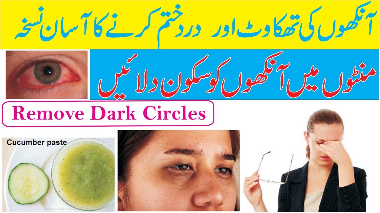 Remove Dark Circles and Rest your Eyes  | TIPS BY JIA