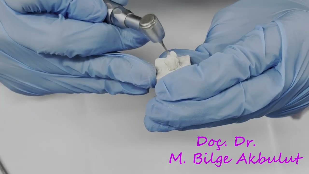 Endodontic access cavity on upper first premolar /Üst 1. küçük azı dişinde endodontik giriş kavitesi