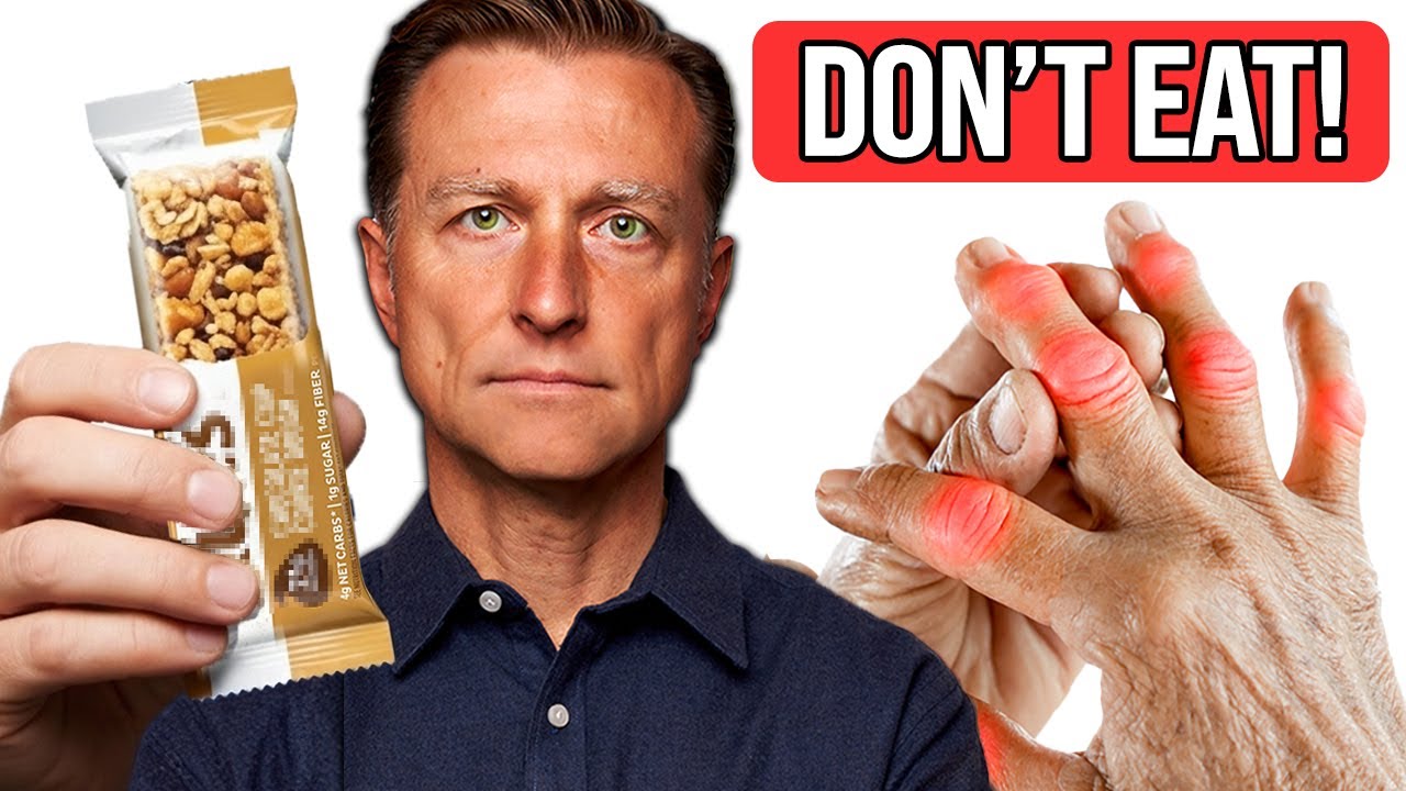STOP Eating These 7 Foods if You Have Arthritis (& What to Eat Instead)