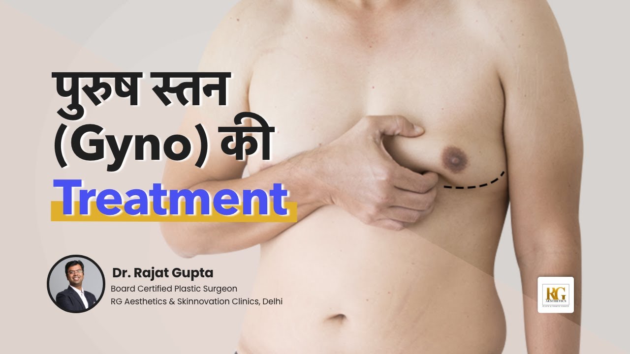 Gynecomastia Ka ilaj | 3 Gynecomastia Grades & How to Treat Them? | Breasts in Male | Dr Rajat Gupta