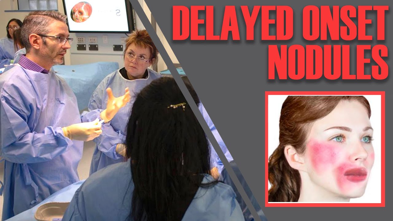 DELAYED ONSET NODULES. How to diagnose & treat lesions after dermal filler [Aesthetics Mastery Show]