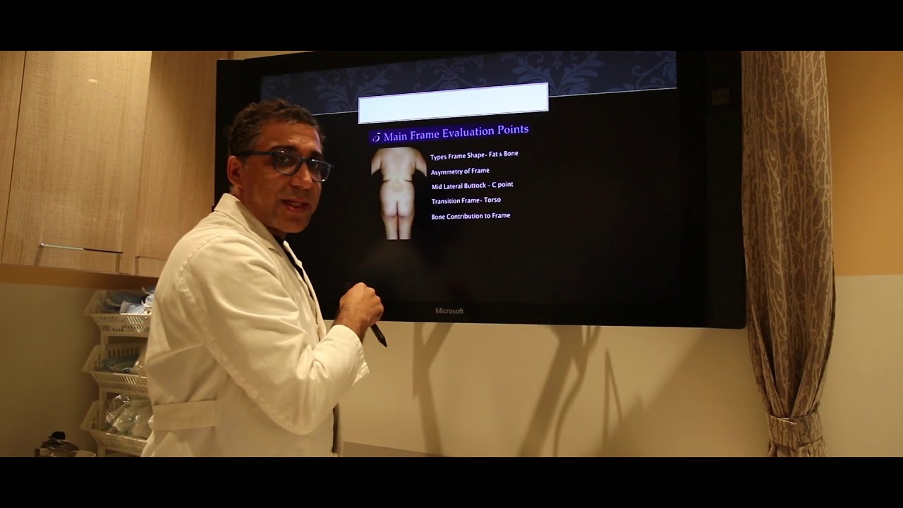 WHAT TO CONSIDER BEFORE YOUR BBL | Dr. Saul Lahijani MD