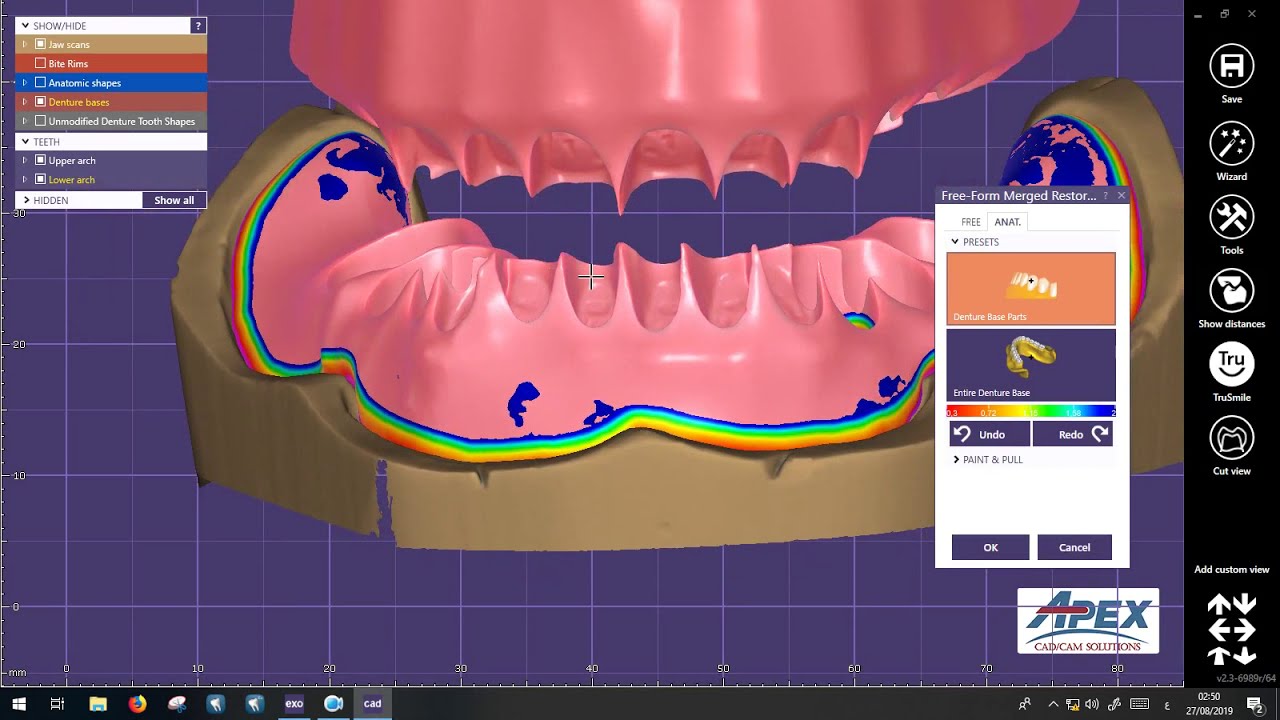 complete  Denture   exocad