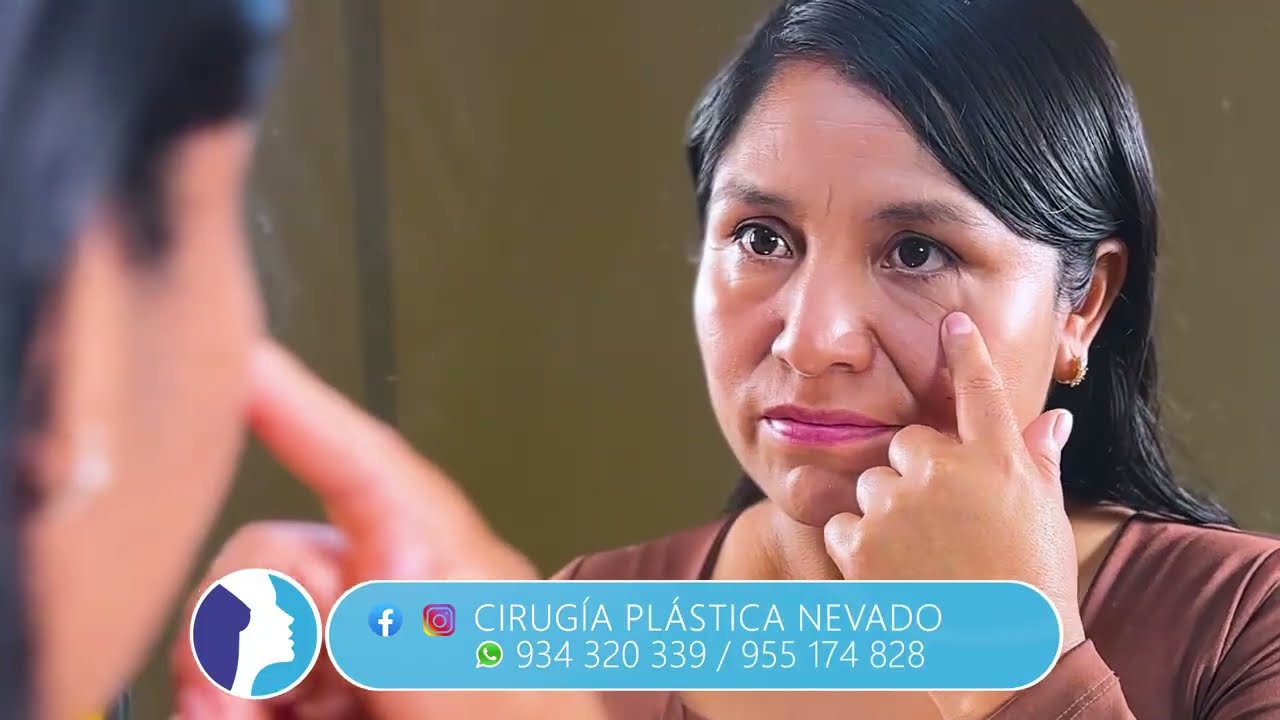 ¿Cómo eliminar las bolsas y los párpados caídos?