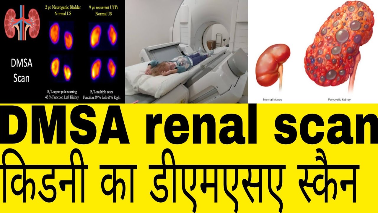 DMSA Renal Scan Hindi. Kidney ka DMSA test kya hai.Awerenes of all