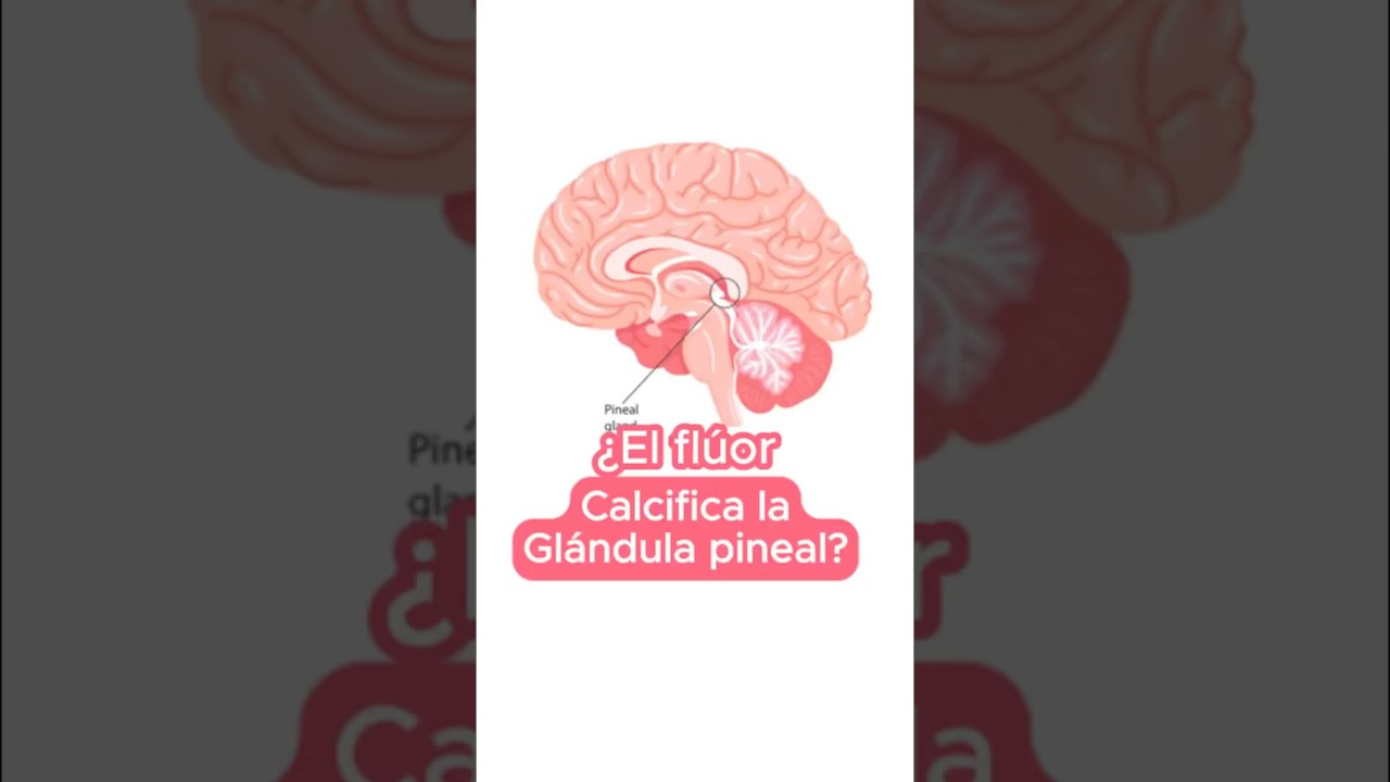 &iquest;El fl&uacute;or calcifica la gl&aacute;ndula pineal ?