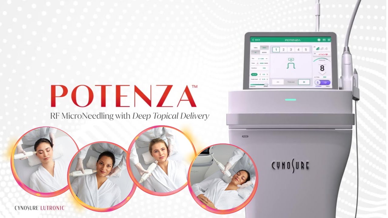 Potenza RF Microneedling | Fusion Tip™ for Enhanced Serum Penetration