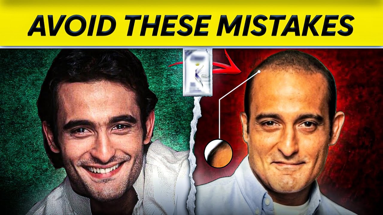 5 WORST Mistakes DESTROYING Your Hair And Making You BALD (Kadwa Sach)