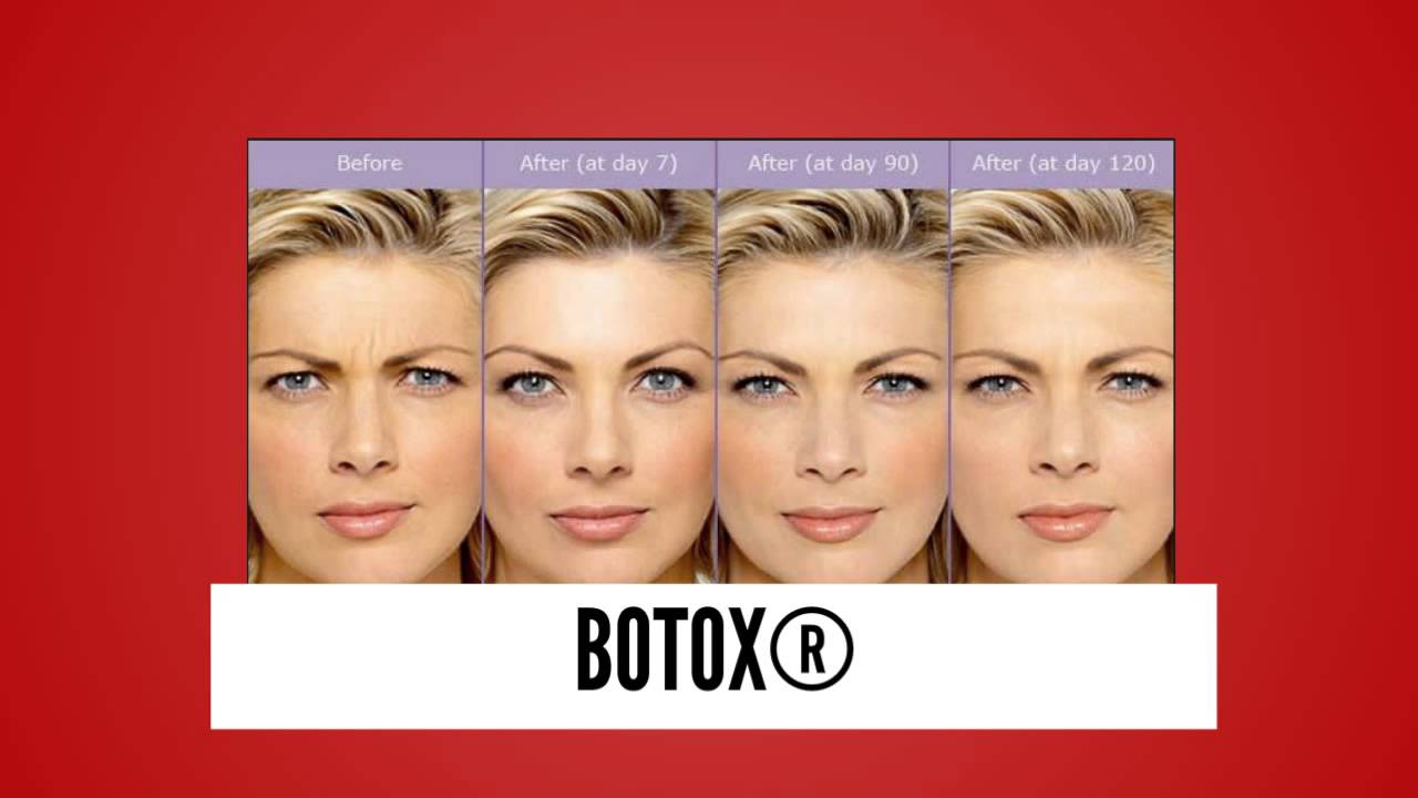 botox west palm beach fl botox palm beach gardens botox palm beach county