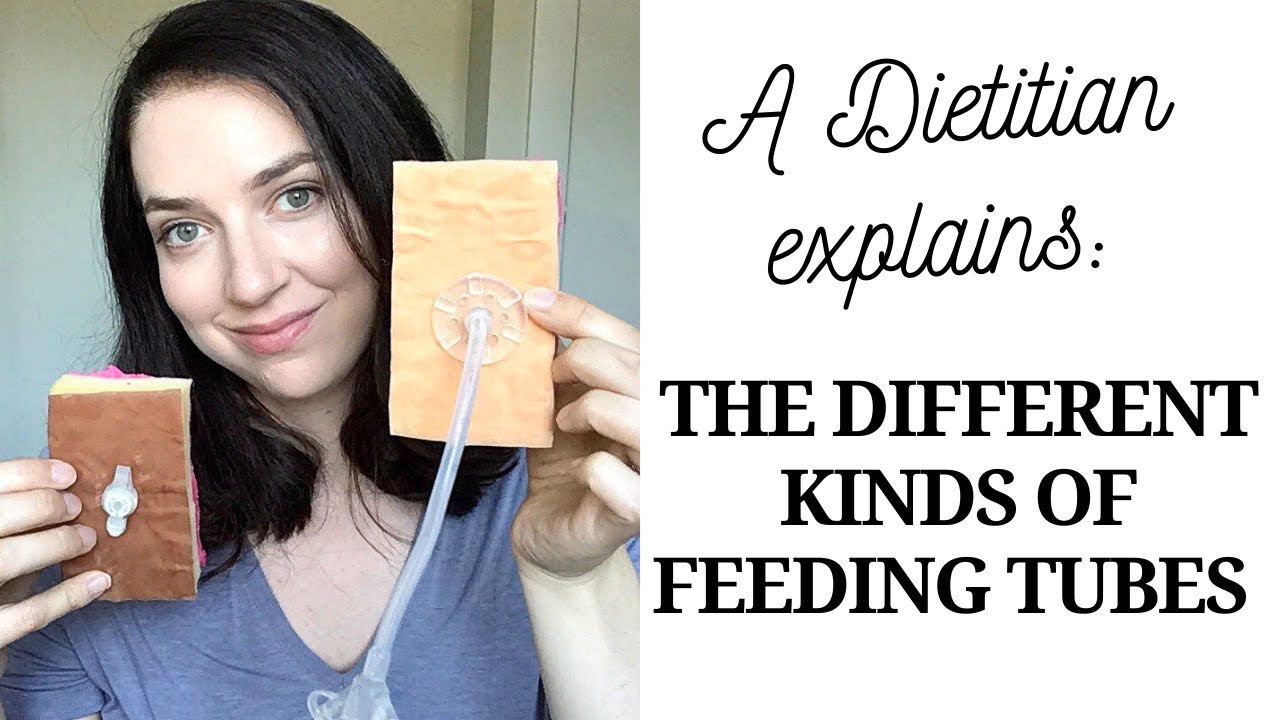Button Style Feeding Tubes vs Regular Tubes: Helpful Information