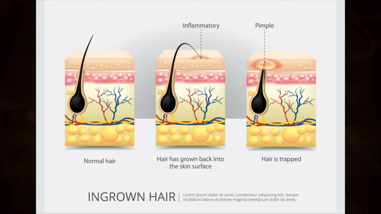 Unveiled: The Battle of Traditional vs. Modern Shaving Techniques!
