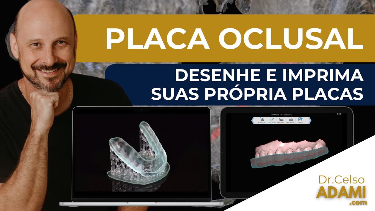 Como Criar uma Placa Oclusal no BlueSky Plan   Passo a Passo Completo