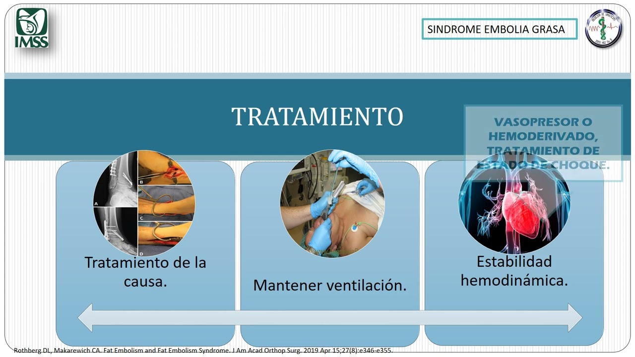 SINDROME EMBOLIA GRASA