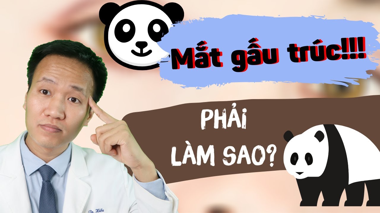 THÂM MẮT phải làm sao - 4 thói quen giúp bạn Trị thâm mắt hiệu quả an toàn | Dr Hiếu