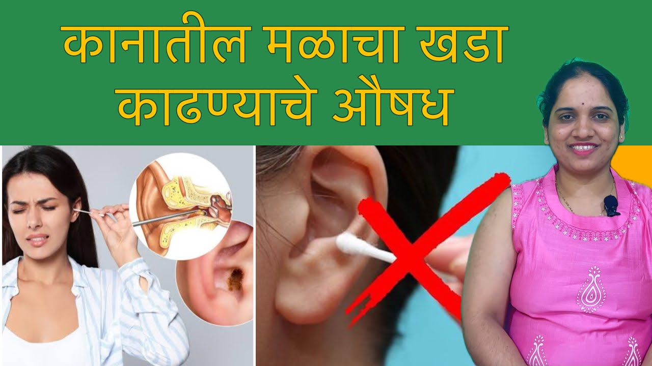 कानातील मळाचा खडा काढण्यासाठी Clearwax Drops | How to remove ear wax safely 