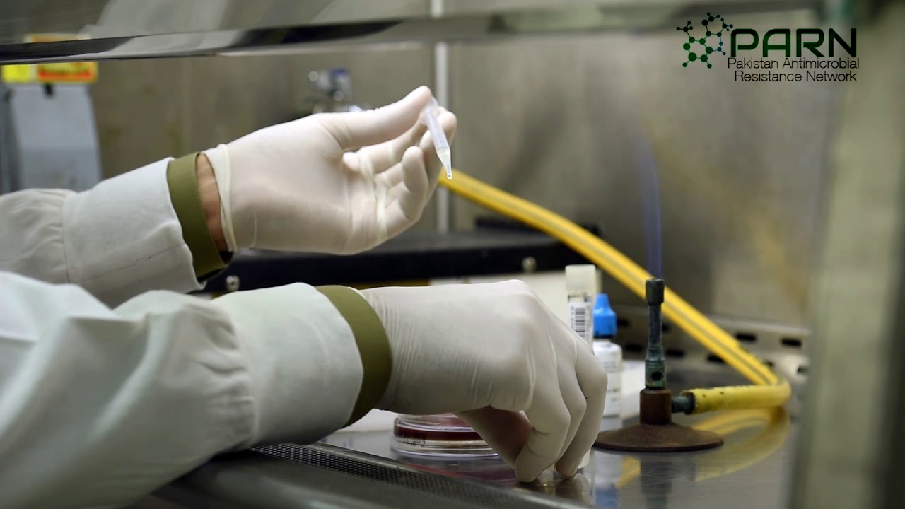 processing of csf