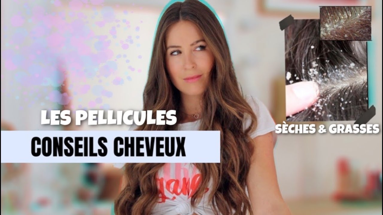ADIEU PELLICULES Sèches et Grasses 👋🏼 | CONSEILS CHEVEUX