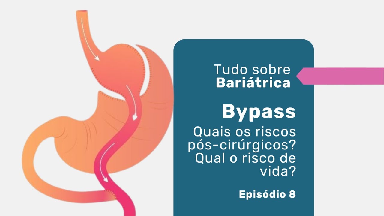 Bypass: As complicações Pós-Cirúrgicas. Quais o Risco de Vida? | Tudo Sobre Bypass | Ep 8