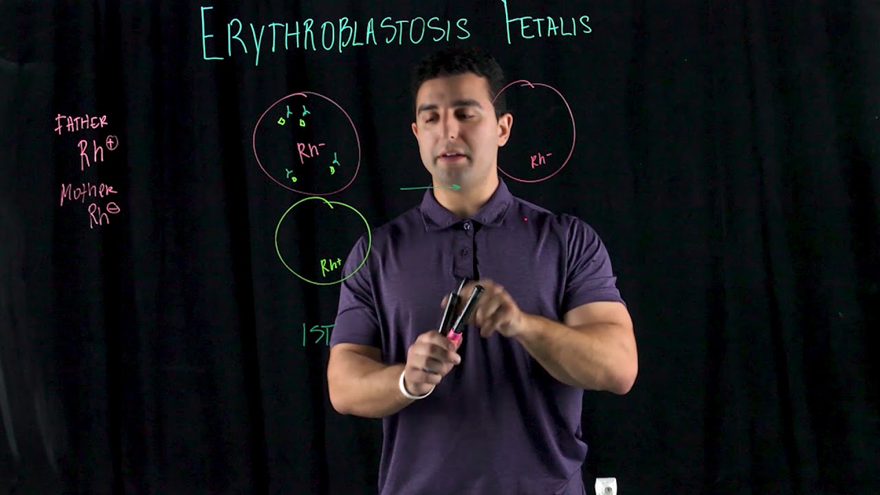 Erythroblastosis Fetalis