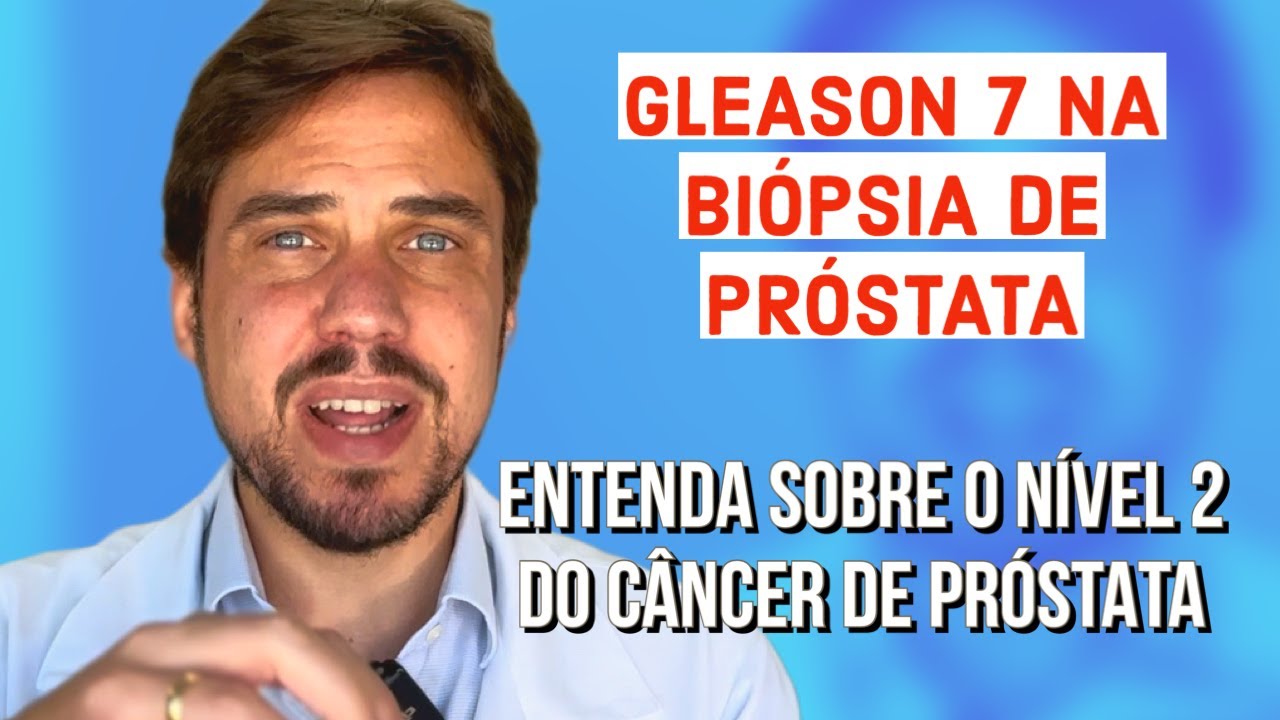 GLEASON 7 NA BIÓPSIA DE PRÓSTATA: ENTENDENDO TUDO SOBRE O NÍVEL 2 DO CÂNCER DE PRÓSTATA