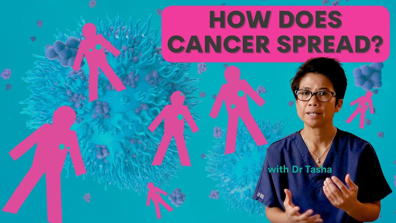Beyond the Lump: Exploring the Spread of Breast Cancer - with Dr Tasha