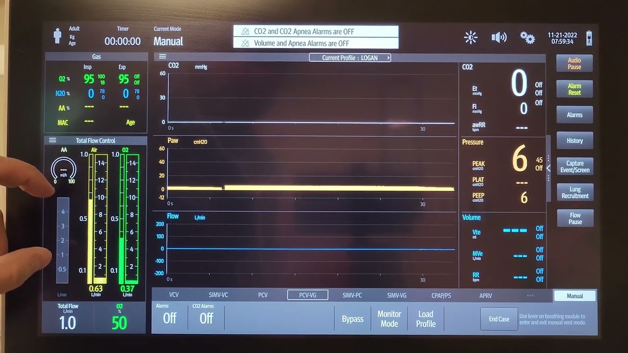 Getting Started with Mindray A8 Anesthesia Machine