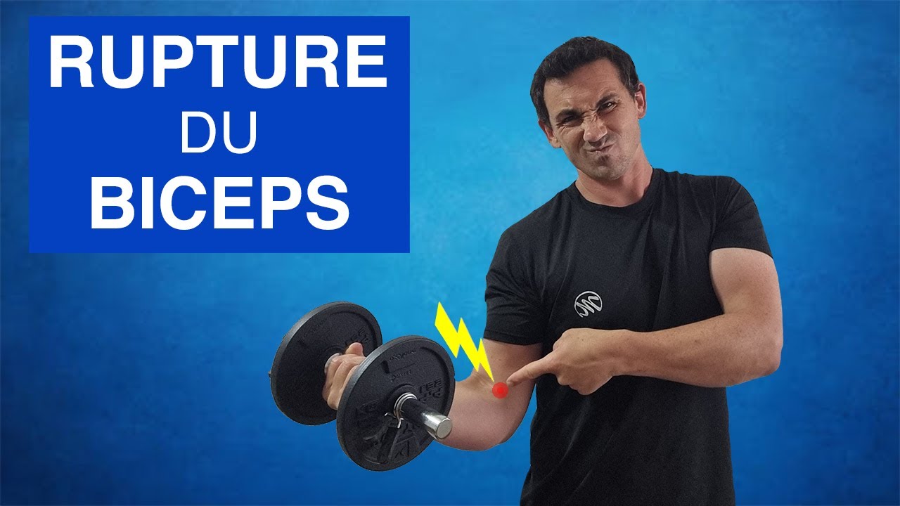 Rupture distale du tendon du biceps : Traitements et Exercices kiné