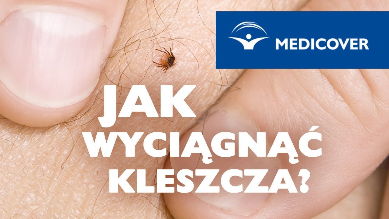 Jak wyciągnąć kleszcza?