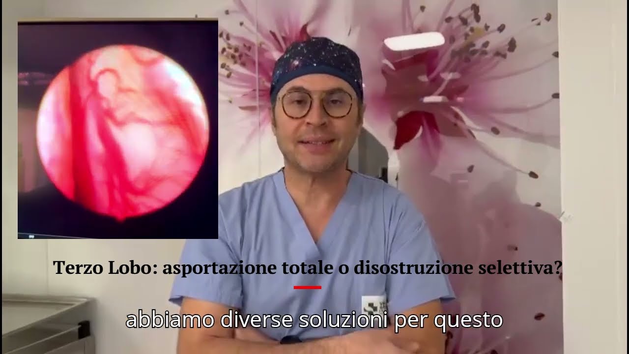 terzo lobo: asportazione totale o disostruzione selettiva?