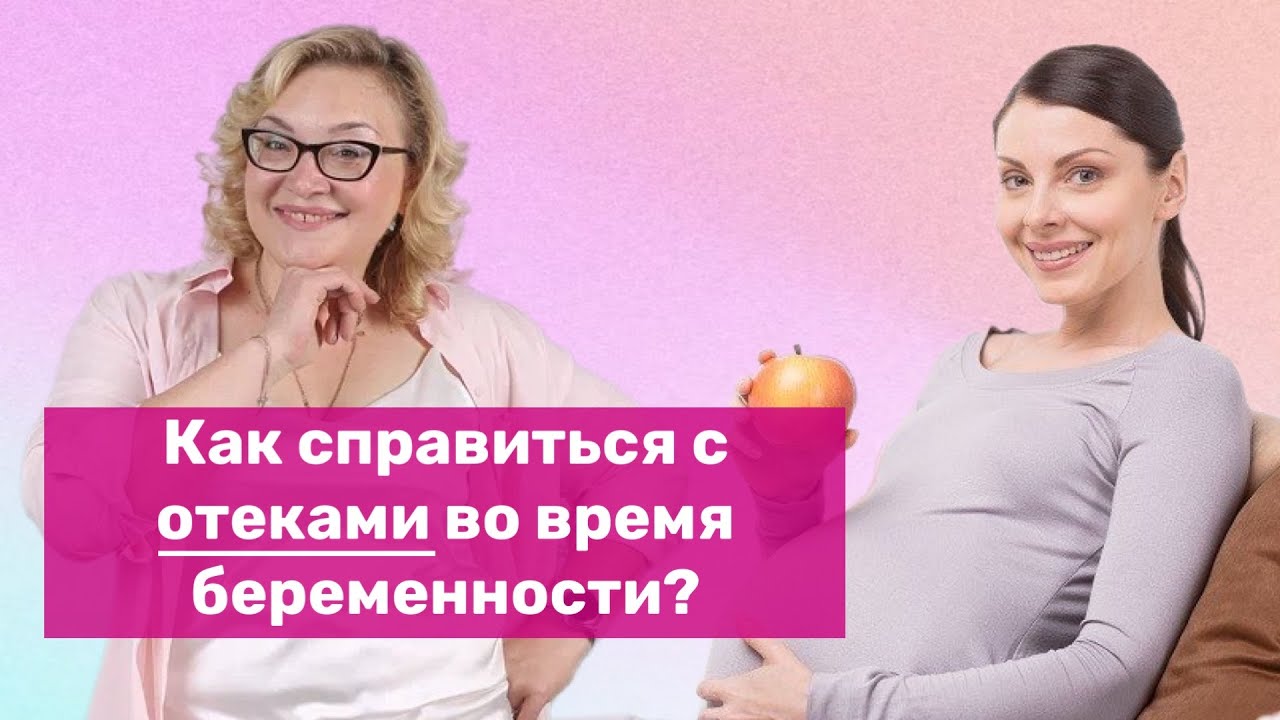 Как справиться с отёками во время беременности?