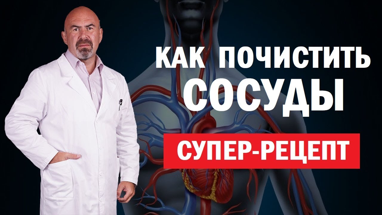 ❤️ КАК ПОЧИСТИТЬ СОСУДЫ. Супер рецепт для сосудов - как почистить сосуды в домашних условиях
