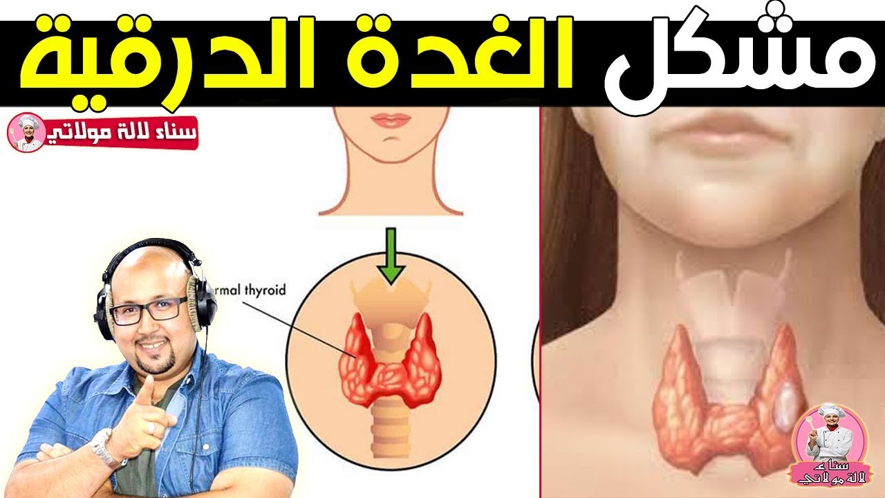 مشكل الغدة الدرقية وطريقة العلاج مع الدكتور عماد ميزاب والدكتورة عفاف الرفاس
