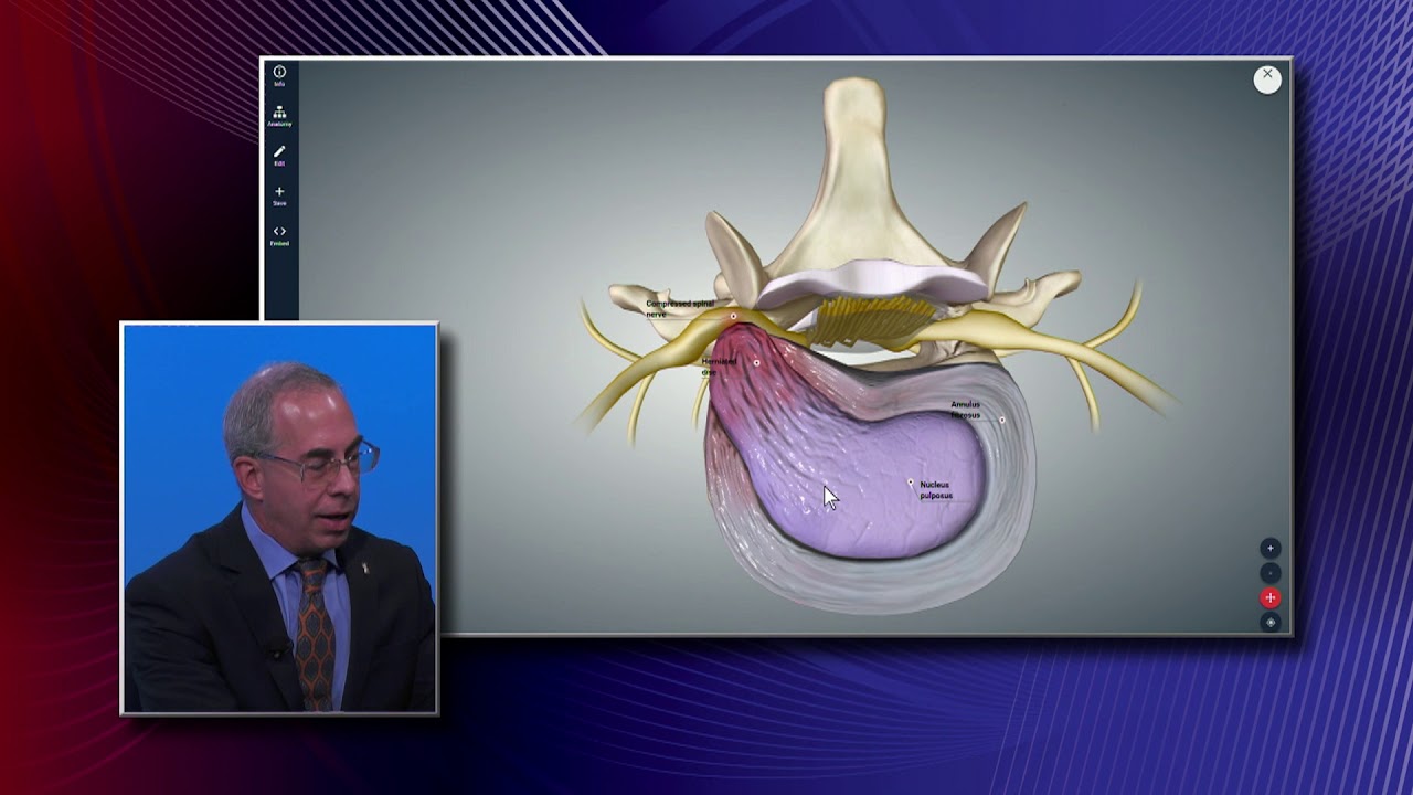 Herniated Disk and Overweight