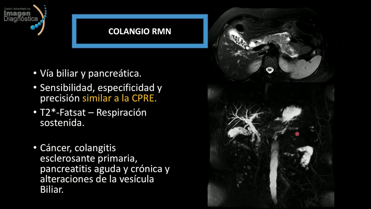 Procedimientos de imagen en la patología gastrointestinal. Dra. Aurora Mercado Sánchez