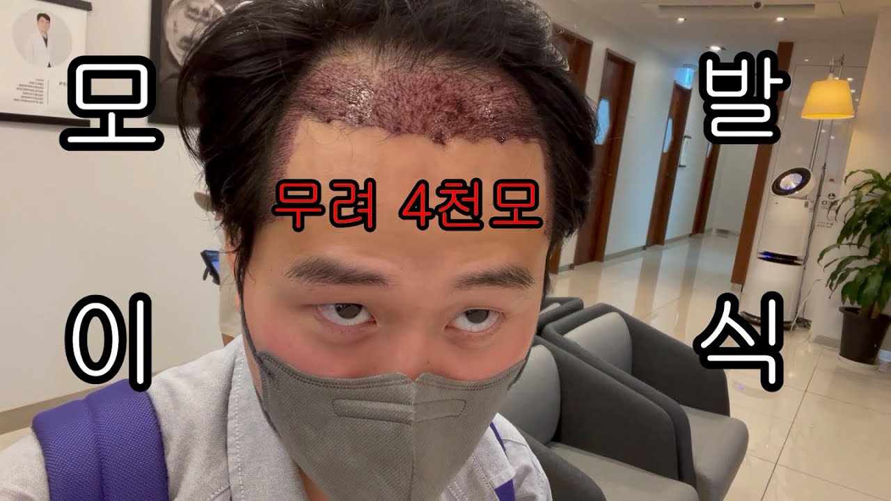 내돈내산 모발이식 후기(약혐) #3 [브이로그]